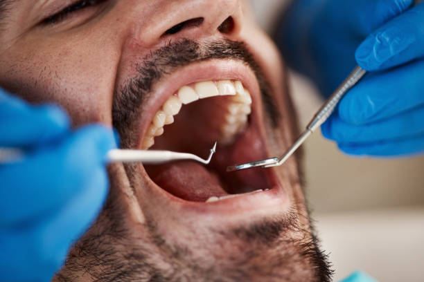 Emergency Dental Services in Burkburnett, TX